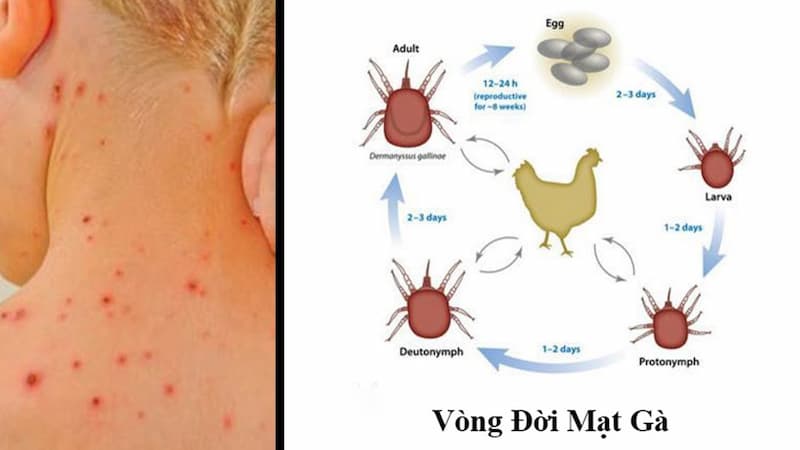 Mạt gà có nghĩa là gì?