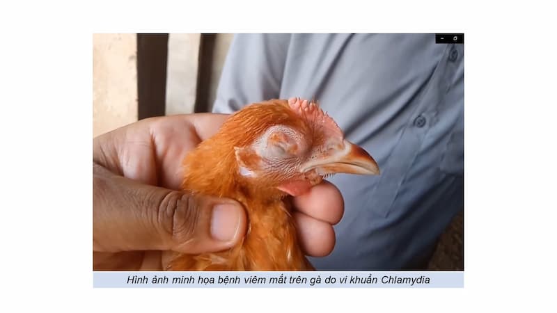 Sưng mắt do vi khuẩn